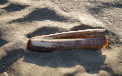 Vaginitis (Scheidenentzündung) – Symptome, Ursachen & Behandlung