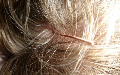 Juckende Kopfhaut: Ursachen & Online-Behandlung durch Hautärzte